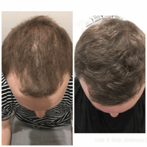 Hair and Skin Science